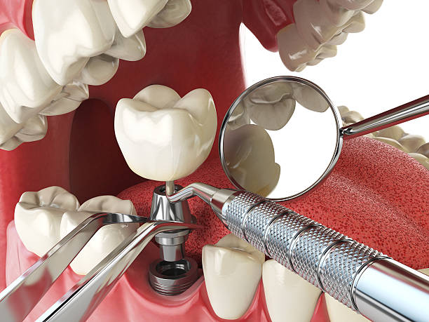 Best Emergency Gum Treatment in Charles Town, WV